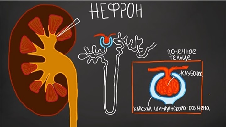 Нефростома в почке фото